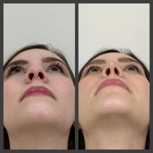 12 (1)